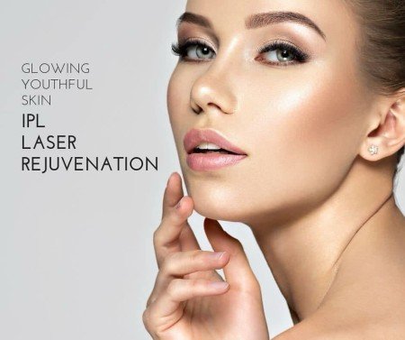 Laser IPL Facials